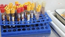 На Ставрополье показатель заболеваемости ВИЧ-инфекцией за год снизился на 4,6%